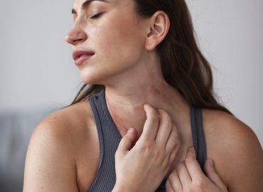 Sudden skin rash on arm — causes and dermatologist treatment guide