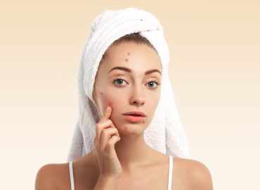 Woman receiving advanced acne scar treatment at a skincare clinic.