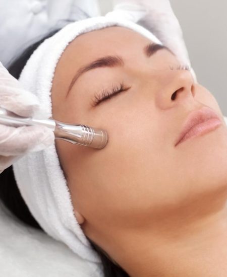 Microdermabrasion Treatment