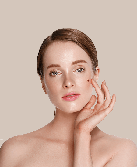 Skin Tag Removal Treatment in Hyderabad/Mole Removal