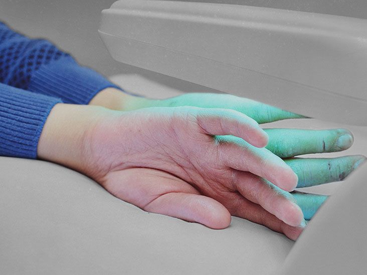 Phototherapy